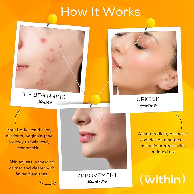 Clear Within Clear Skin Vitamin - with 10 Natural Ingredients for Acne-Free, Clearer Complexion, Oil Control & Blemish Minimization. Supports Skin Clarity | Non-Synthetic 60 Cap/Bottle-StrideForce Fitness