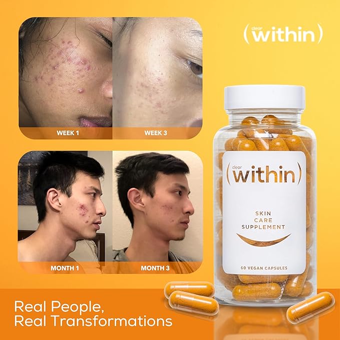 Clear Within Clear Skin Vitamin - with 10 Natural Ingredients for Acne-Free, Clearer Complexion, Oil Control & Blemish Minimization. Supports Skin Clarity | Non-Synthetic 60 Cap/Bottle-StrideForce Fitness