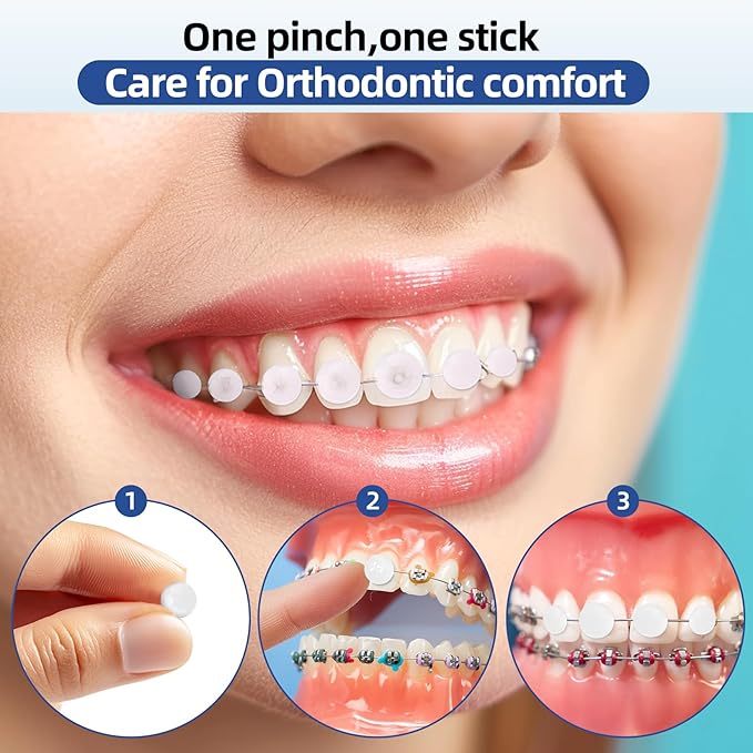 RAZOKO Orthodontic Wax for Braces Wax Dots 120 Individual Hygienic Packaging Dental Wax Mint