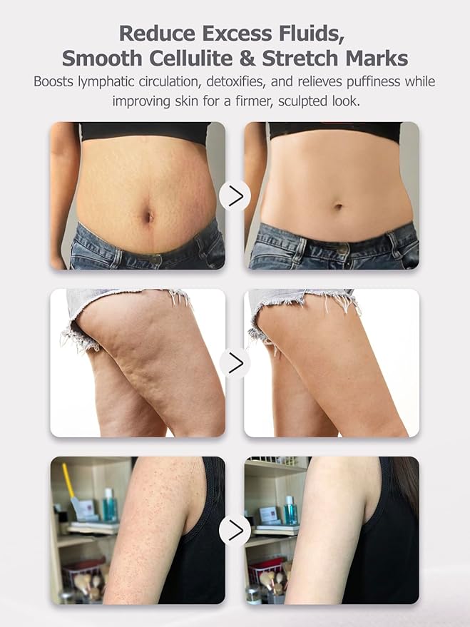 Lymphatic Drainage Massager & Anti Cellulite Massage Tool, Reduce Stretch Marks & Cellulite, for Legs, Arms & Belly, Body Sculpting Machine with Microcurrent, Light, Heat & Vibration,Blue-StrideForce Fitness