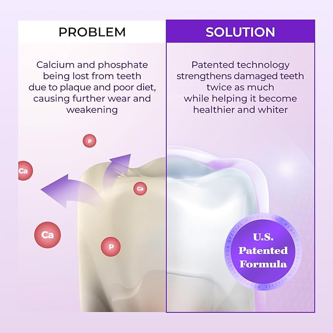 HIMALAYA PINKSALT Purple Whitening Toothpaste - Teeth Whitening, Deep Stain Remover with Fluoride, Plaque Remover, Appropriate for Sensitive Teeth, Peroxide Free - Vanilla Mint, 3.5 oz (3 Packs)