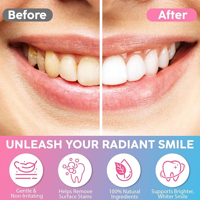 Niacinamide Whitening Toothpaste - Gentle Daily Care