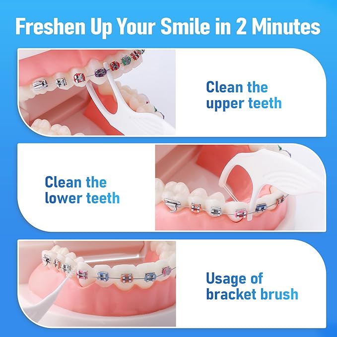 200 Count Twin-Line Braces Flossers, Orthodontic Flossers for Braces, Fits Under Arch Wire No Damage, Whale Wider Handle with Unique Finger Press, Ortho Dental Floss for Kids & Adults, Mint
