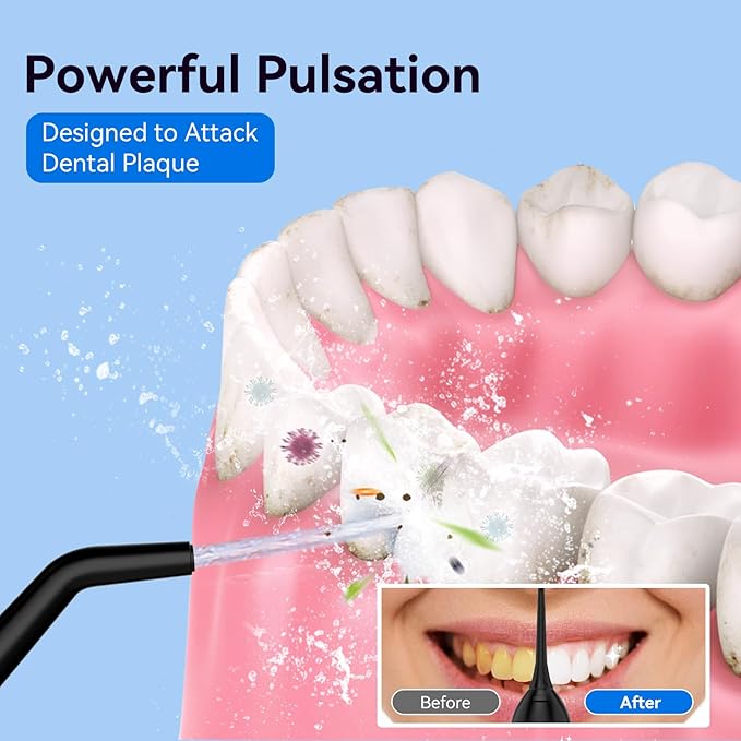 Cordless Portable Water Flosser with 300ML Tank: Rechargeable Oral Irrigator with 5 Tips for Travel, Braces Care and Sensitive Gums, IPX7 Waterproof Teeth Cleaning Device(Black)