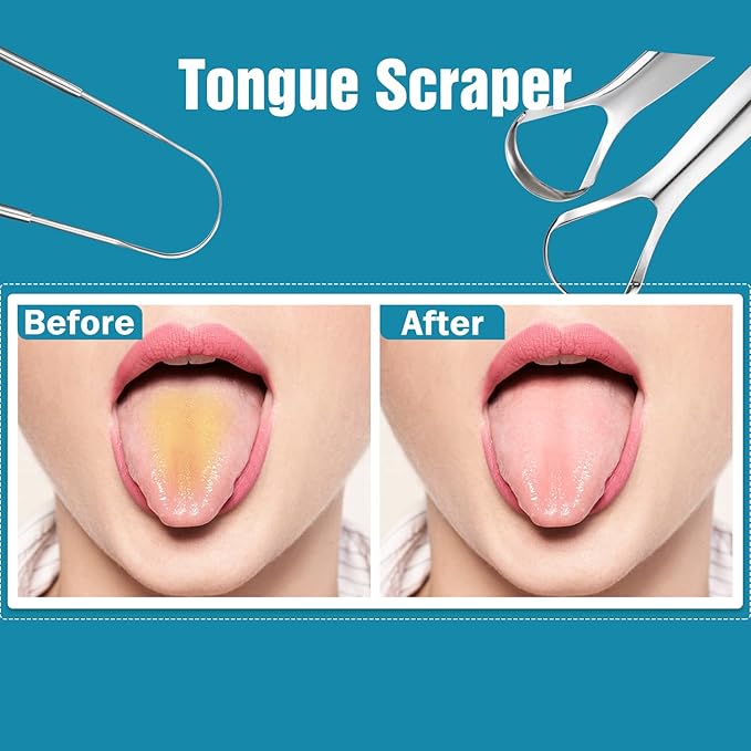 3 PCS Metal Tongue Scraper, Tongue Scrapers for Adults, Stainless Steel Tounge Scrappers, Tounge Scraper, Portable Tongue Scrappers YLYL