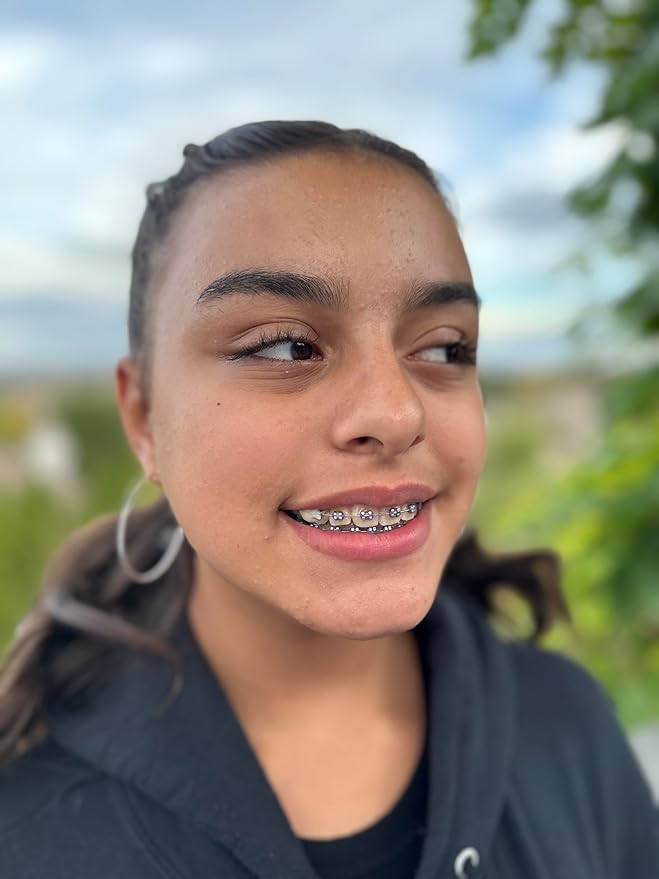 Organic Orthodontic Wax – Natural Braces Protection, Long-Lasting Comfort, Pre-Cut Wax Pieces in Aluminum Travel Case (75 Buttons) - Orange Clove