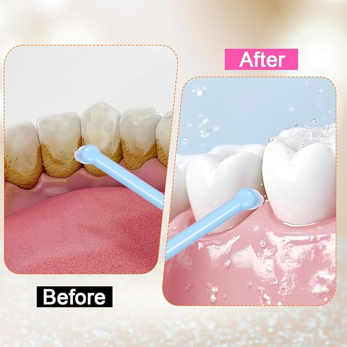 8 Pcs Soft Bristles Angled Toothbrush End Tuft Toothbrush with Covers Single Tufted Toothbrushes Small Head for Hard-to-Reach Areas Orthodontic Toothbrushes for Braces, Implants, Back Teeth, Retainers