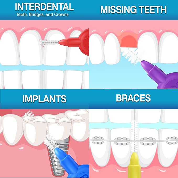 Paro Swiss 3Star-Grip Interdental Brushes – Assorted, 4x1 Pack Different Sizes – Deep Between Teeth Cleaning