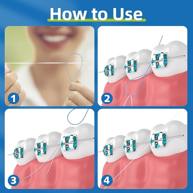 RioRand Floss Threaders, Essential Tool for Maintaining Oral Health with Braces, Bridges, and Implants 400Count (Pack of 4)