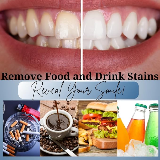 Teeth Whitening Kit 4 Syringes (3ml) New Strongest 44% Carbamide Peroxide Teeth Whitening Gel Light Trays Retainer Case Included Vegan Tooth Whitener