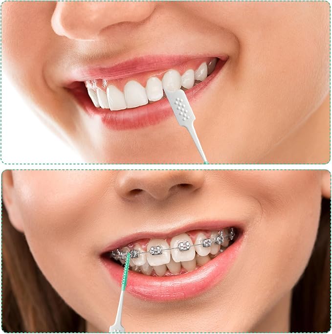 Dental Floss Picks Soft Silicone interdental Brush, Braces Brush, Floss Picks for Teeth, Disposable interdental Brush, Suitable for Cleaning Teeth Health(Green, 160pcs)