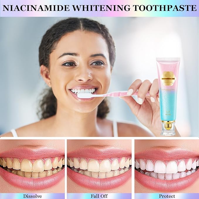 2Pcs Acssart Radiant Whitening Toothpaste,Unismart Toothpaste Whitening,Niacinamide Whiteing Toothpastes,Niacinamide Toothpastes,Deep Cleaning Care