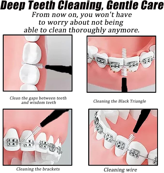 130-Count Interdental Brushes Set - Black & White Orthodontic Cleaning Kit with Spiral Brush Heads, Braces-Friendly Flossers & Toothpicks for Efficient Teeth & Braces Care