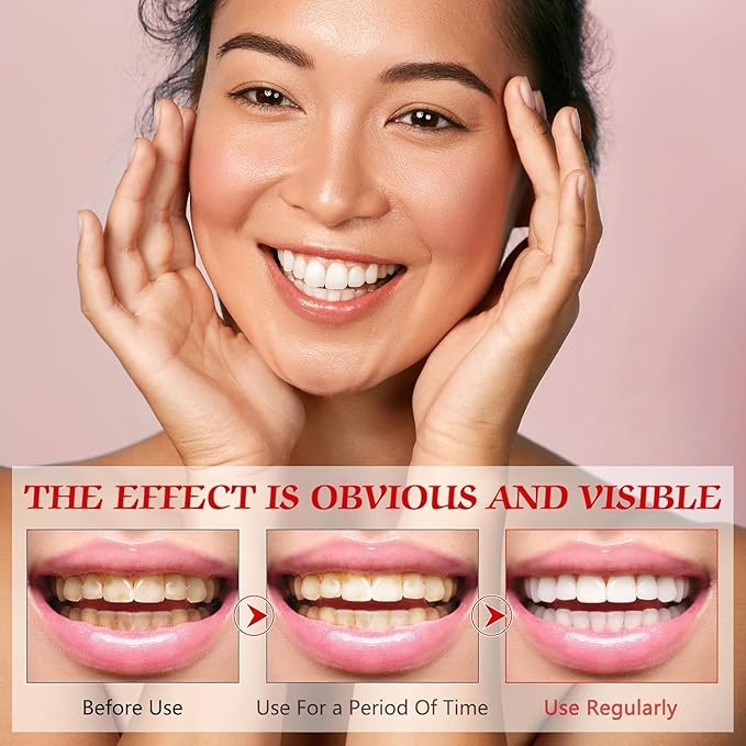 Super ProbioticSp-8 Toothpaste, Sp 8 Pasta Dental, SP-8 Toothpaste, Pasta Dental Sp-8,SP8 Probiotic Toothpaste, Deep Cleaning Care Toothpaste