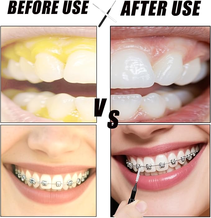 130-Count Interdental Brushes Set - Black & White Orthodontic Cleaning Kit with Spiral Brush Heads, Braces-Friendly Flossers & Toothpicks for Efficient Teeth & Braces Care