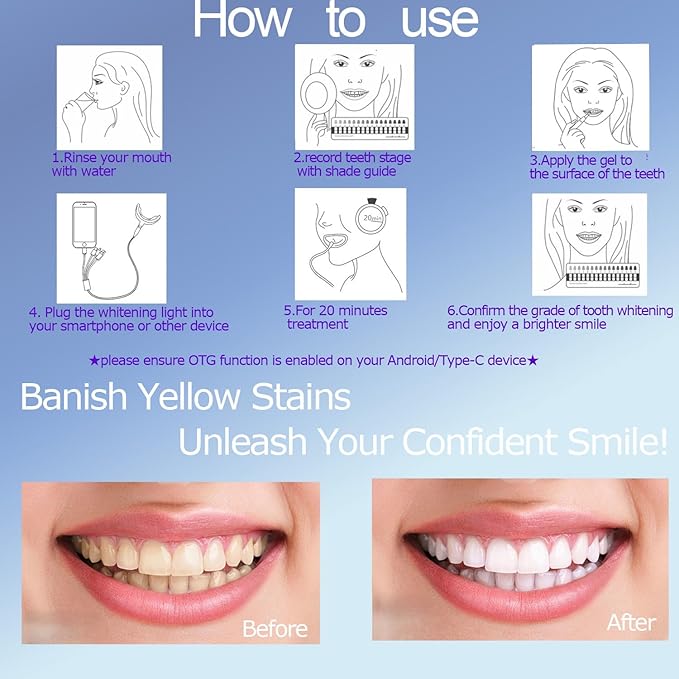 TAWEE Teeth Whitening Kit Safe for Sensitive Teeth & Enamel Wired Tooth whitening Accelerator Light with 16 Blue LED Pure White Teeth Whitener Waterproof