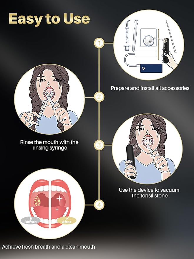 Voraiya Tonsil Stone Removal Vacuum Kit with 5 Mode Suction, 10 in 1 Electronic, Oral Irrigator, Tongue Scraper, Oral lamp & 5X Magnifying Mirror Included for Fresh Breath