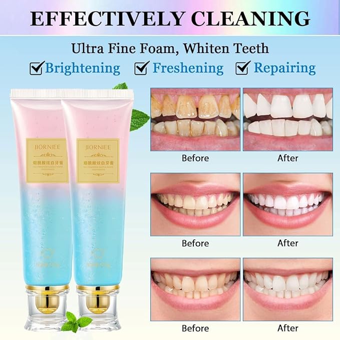 Niacinamide Whitening Toothpaste, Niacinamide Strengthen Toothpaste, Appropriate for Sensitive Teeth Remove Tooth Stains Fresh Breath (2) ﻿ ﻿