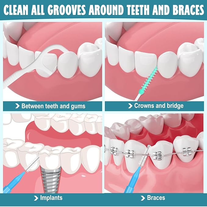 Lezmarket 450PCS Interdental Brushes and Flosser Picks Kit, Braces Brushes, Soft Picks and Dental Floss Sticks for Teeth, Braces Cleaner Brush Tooth Floss Pick Between Teeth Brushes for Braces