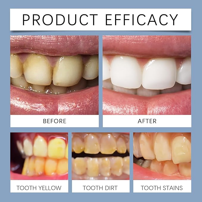 Premium Teeth Whitening Strips with Coconut Oil, Gentle Brightening Care for Sensitive Teeth, 60 Minutes Application to Enhance Your Smile, 7 Pieces