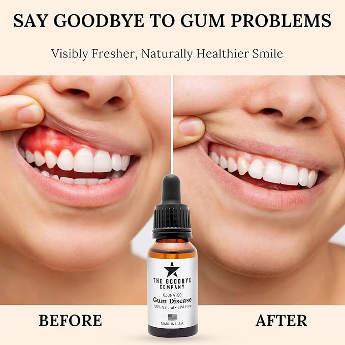 The Goodbye Company Ozonated Gum Treatment Oil – Home Remedy for Periodontal Disease & Gingivitis Relief – 100% Pure Clove & Neem Essential Oils for Healthy Gums, Soothes Pain & Stops Bleeding – 15 ml