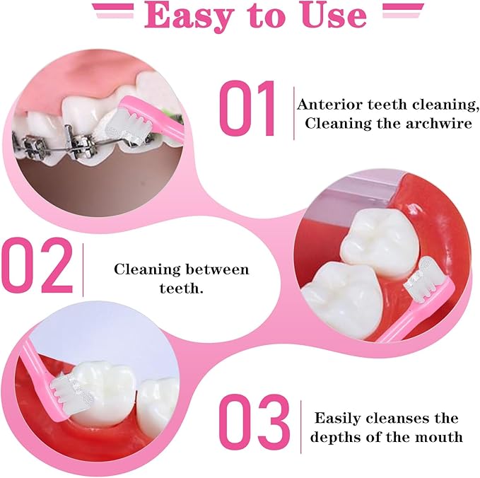 2Pcs Orthodontic Tooth Brush, Soft End Tapered Wisdom Toothbrush, Small Head End Tuft Toothbrush for Adult, Periodontal, Detail Cleaning (Pink Green)