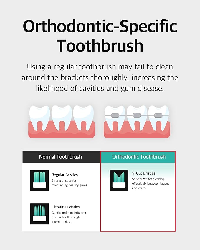 V-Cut Orthodontic Toothbrush (Mint 3 Units + White 3 Units) - Compact Head for Braces, Ergonomic Handle, Deep Cleaning, Gentle Bristles for Brackets and Wires