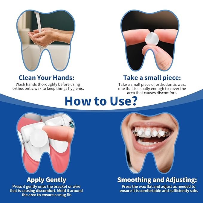 Orthodontic Wax for Braces - 180 Dental Wax Dots | Mint Flavor, Hygienic Individual Wraps, Brace Wax for Brackets