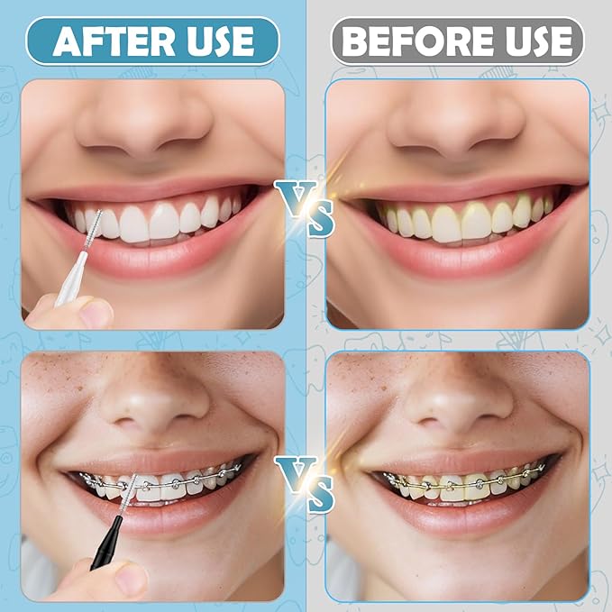 120 Pieces Interdental Brushes, Braces Brush Cleaner Orthodontic Flossers with Soft Bristles 360° Bendable Toothpicks Floss Picks for Braces Kit for Teeth Cleaning Tools