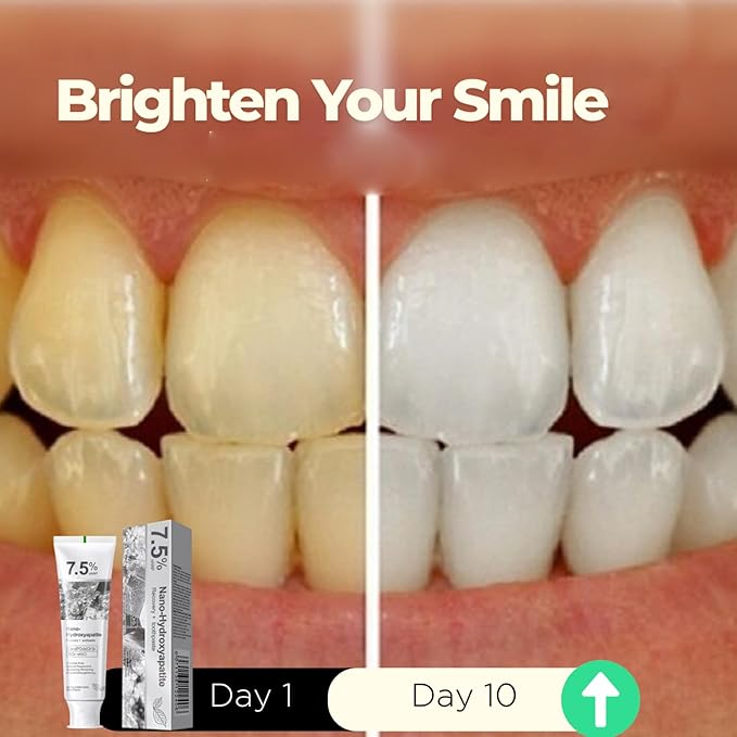 Hydroxyapatite Toothpaste, 7.5% Nano Hydroxyapatite Toothpast, Deep Cleaning for Advanced Enamel Protection, Fluoride-Free Gentle and Effective Formula with Fresh Mint (1 Set)