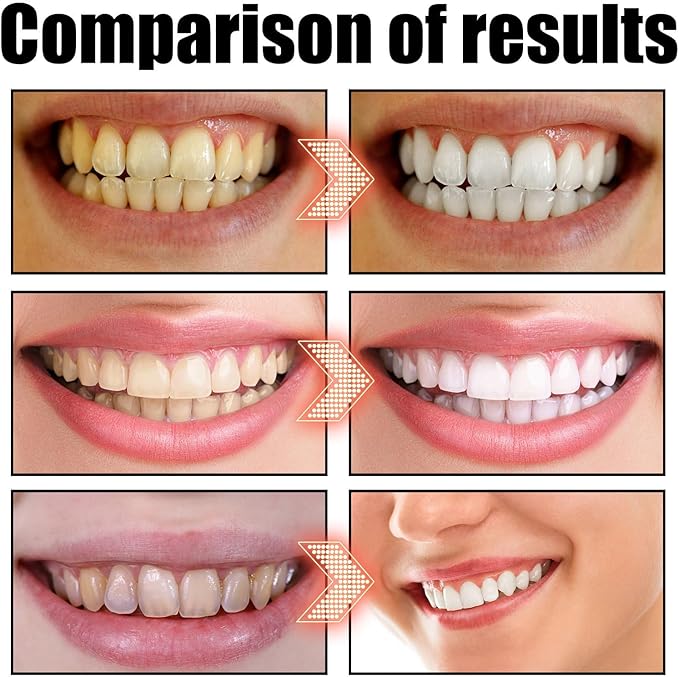 Coconut Oil Pulling for Teeth Whitening-Cocofresha Powerful Organic Coconut Peppermint Pulling Oil for Teeth and Gums, Pure Mouthwash Mint Freshness, Natural Cleanse, 4 Oz (2)