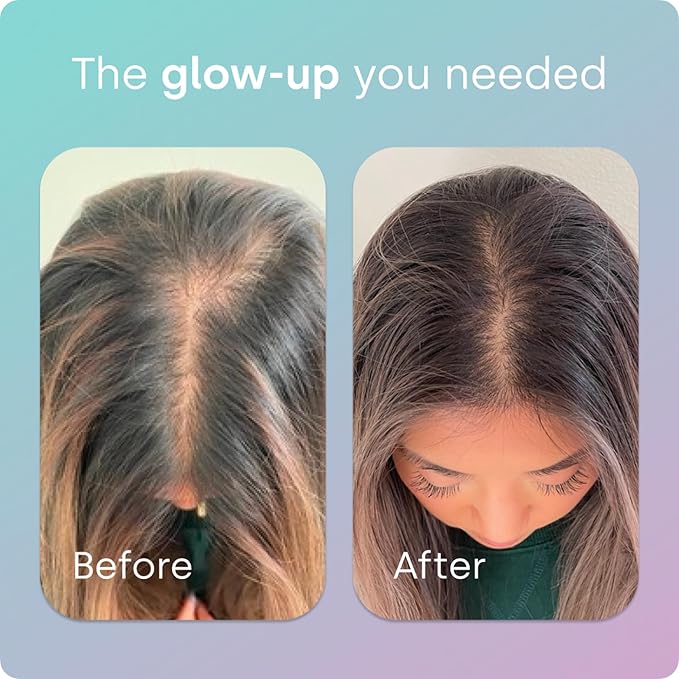 Biosil Advanced Hair + Nail Care - Growth Vitamins for Women - Strengthen & Thicken Strands - 60 Capsules - Patented ch-OSA - 30-Day Supply-StrideForce Fitness