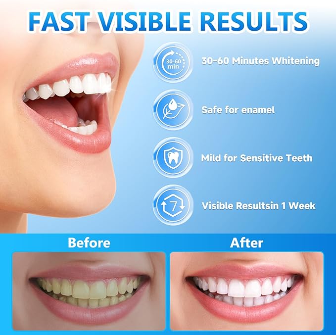 Teeth Whitening Strips for Sensitive, 42 Strips Whitener Safe Whitestrip, Deep Stains Removal Tooth Whitening, Enamel Safe Non-Slip Dry Strip Technology for Whiter Teeth, Mint