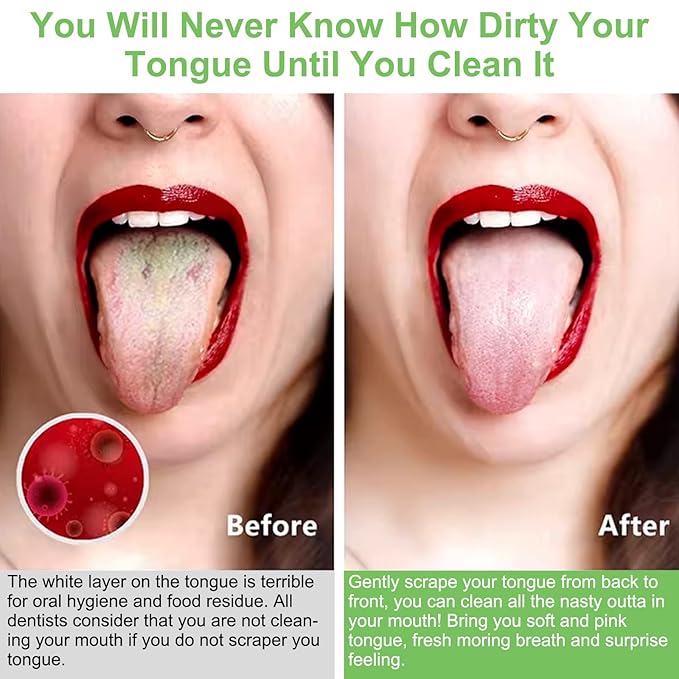 2-Pack Stainless Steel Tongue Cleaner with Travel Cases, Reusable Oral Hygiene Tool for Fresh Breath, Rust-Resistant Metal Tongue Brush for Adults