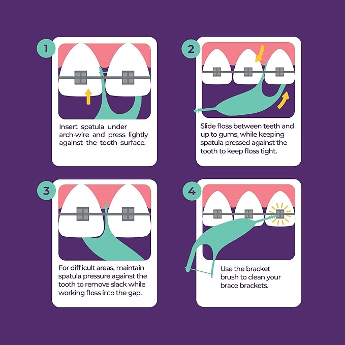 Platypus Orthodontic Flossers for Braces Family Pak - Unique Structure Fits Under Arch Wire, Increase Flossing Compliance, Floss Teeth in Less Than Two Minutes - 75 3-Count Flossers (225 Total)