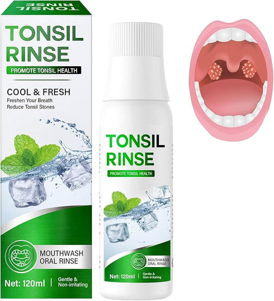 Tonsil Stone Remover Mouthwash - Alcohol-Free Oral Rinse to Soothe Tonsils and Combat Bad Breath, 4 Fl Oz