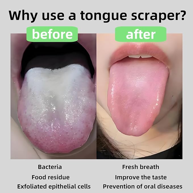 Tongue Scraper Bling Metal Tongue Cleaner for Adults & Kids Diamond Stainless Steel Tongue Scrubber for Oral Care & Hygiene(Colorful)