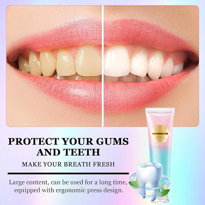 2Pcs Acssart Radiant Whitening Toothpaste,Unismart Toothpaste Whitening,Niacinamide Whiteing Toothpastes,Niacinamide Toothpastes,Deep Cleaning Care