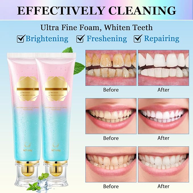 2Pcs Acssart Radiant Whitening Toothpaste,Unismart Toothpaste Whitening,Niacinamide Whiteing Toothpastes,Niacinamide Toothpastes,Deep Cleaning Care