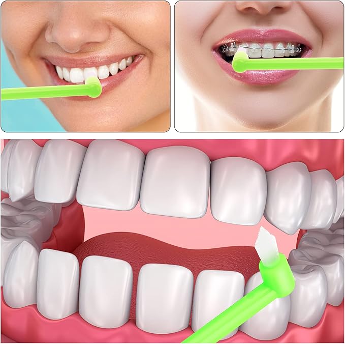 Ouligay 4Pcs End Tuft Toothbrush Adult, End Tuft Brush, Single Tufted Toothbrush Orthodontic Toothbrushes for Braces, Small Head Tiny Interdental Interspace Brush for Detail Cleaning