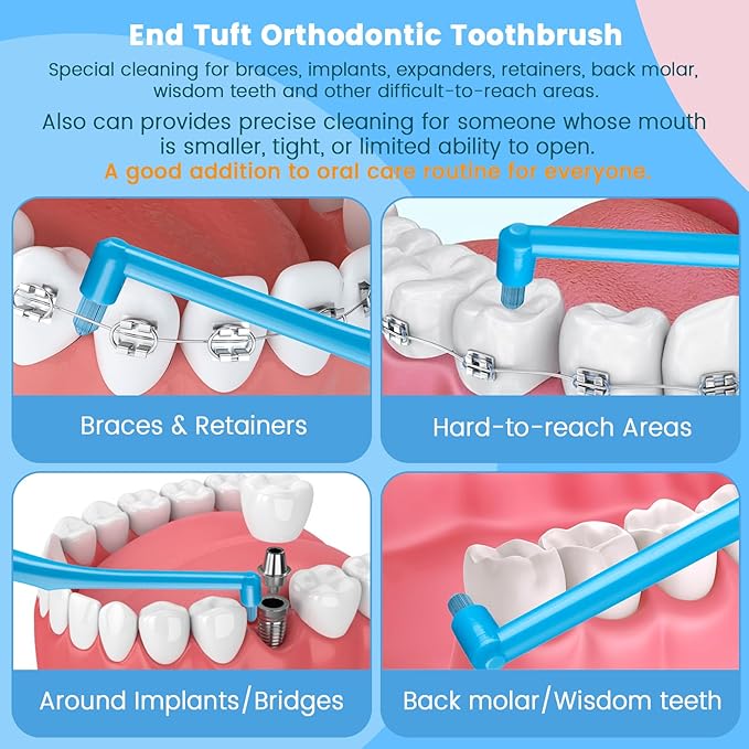 Fregum End Tuft Toothbrush for Orthodontic, Soft Bristles Angled Toothbrush for Braces, Implants, Retainers, Back Teeth, and Wisdom Teeth, 6 Pcs