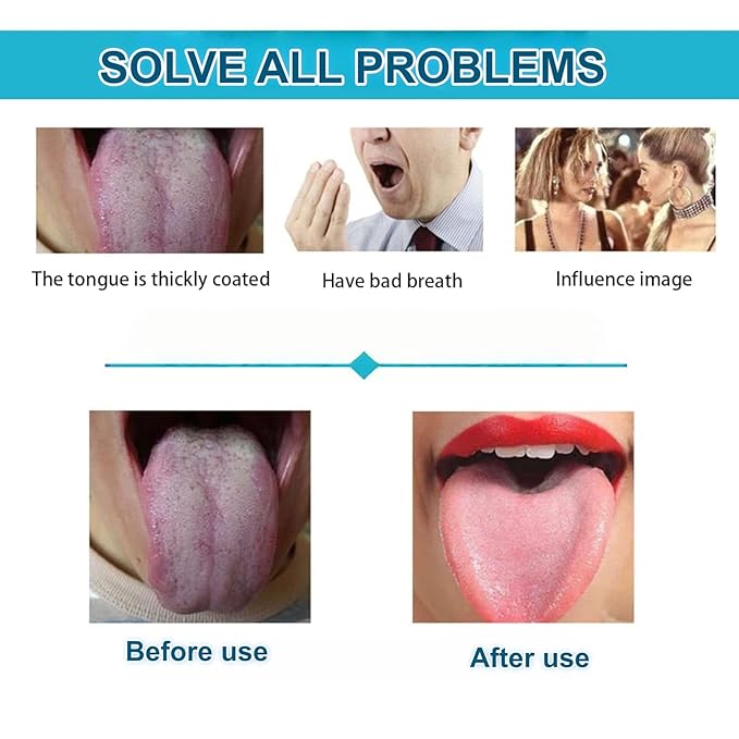 3pcs Stainless Steel Tongue Scraper Kit – Deep Clean Thick Coating & Eliminate Bad Breath, Flexible Bristle-Free Design with Comfort Handle, Hygienic Oral Cleaner for Daily Use & Travel