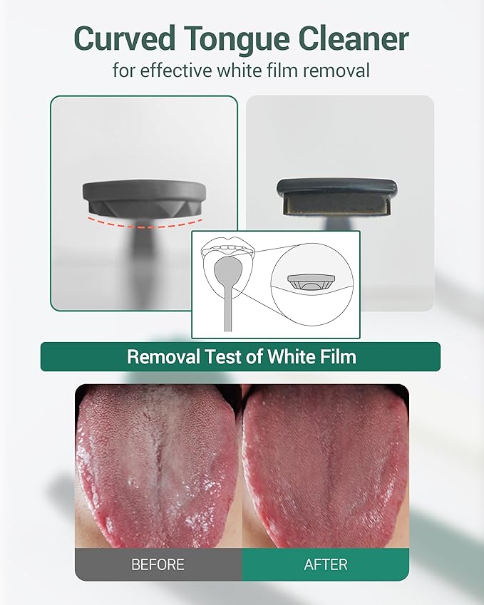 DEARCUS Korean Tongue Scraper with 3 Replaceable Heads - 100% BPA Free TPE Tongue Cleaner - Reduce Bad Breath & Without Hurt - Hygienic Scraper - Modern & Simple Design (Gray)