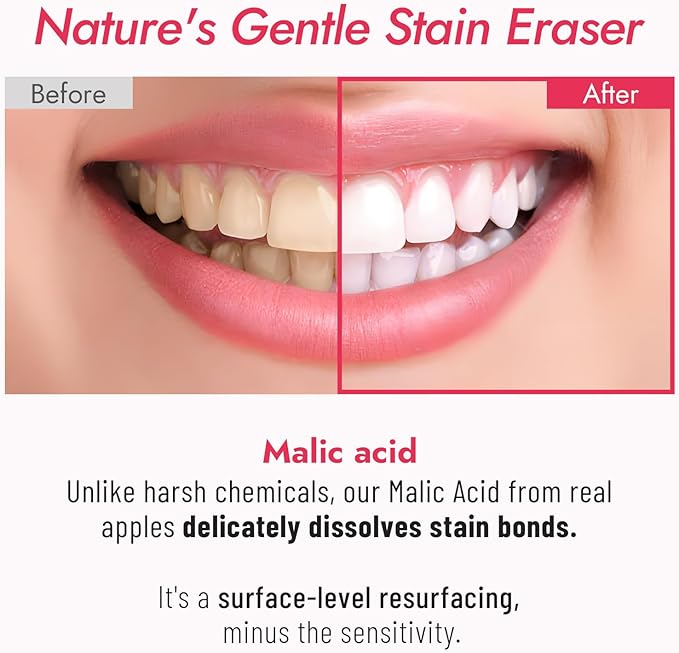 MALIC Acid Teeth Whitening Toothpaste,Natural Care Deep Stain Removal&Plaque,Fluoride Free,Non Toxic,for Adults, Kids and Sensitive Teeth，with Niacinamide，3.57oz.
