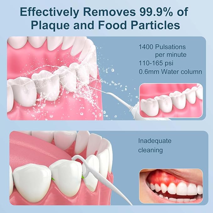 Froomer Cordless Water Flosser – Rechargeable Portable Electric Water Flosser for Teeth, Braces, 5 Modes, IPX7 Waterproof, Travel Friendly, 300ml, White