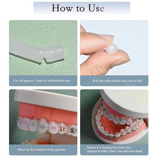 Orthodontic Wax for Braces 10 Boxes 50 Strip Odorless Braces Wax Dental Wax for Aligner, Dental Care, Prevent Mouth Injury