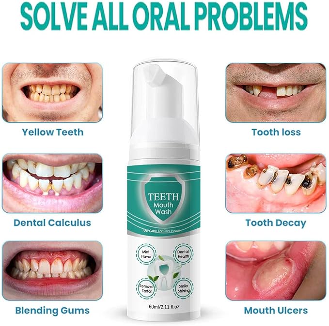 2PCS Foam Toothpaste,Stain Removal Toothpaste for Sensitive Teeth, Ultra-fine Mousse Foam, Deeply Cleans Gums, Removes Stains, Refreshes Breath (2)