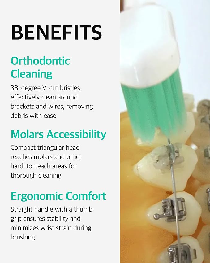V-Cut Orthodontic Toothbrush (Mint) x 6Units – Medium Bristles, Ergonomic, Travel-Friendly Manual Toothbrush for Adults