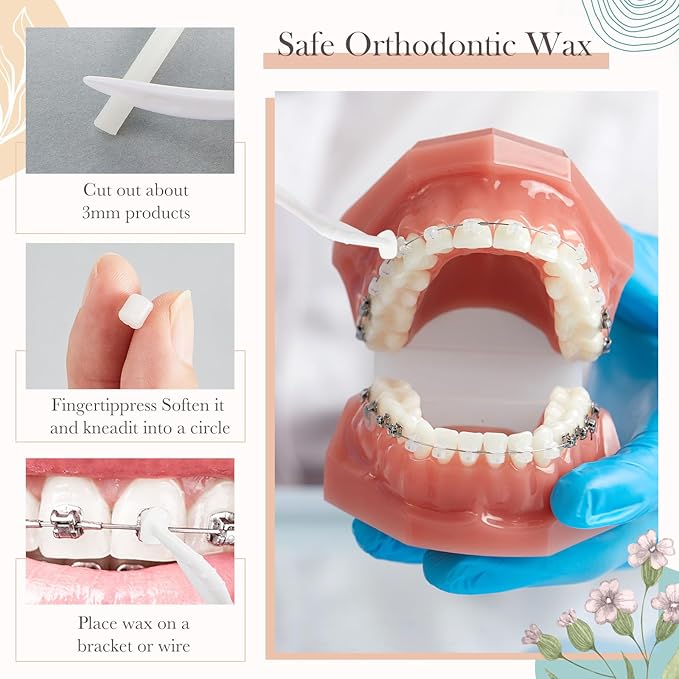 Tondiamo 40 Pack Clear Braces Wax for Teeth Dental Wearer Orthodontic Tooth Wax for Braces and Oral Appliances with Colorful Storage Case and Smell(Floral, Fruity)