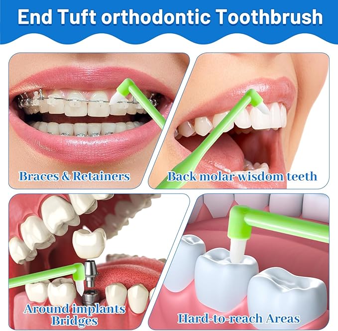 6 Pack End-Tuft Toothbrushes with Covers for Orthodontic Wisdom Teeth Care, Small Head Single Tuft Dental Brush for Plaque Removal, Braces, Interdental Cleaning, Soft Bristles for Adults Oral Care
